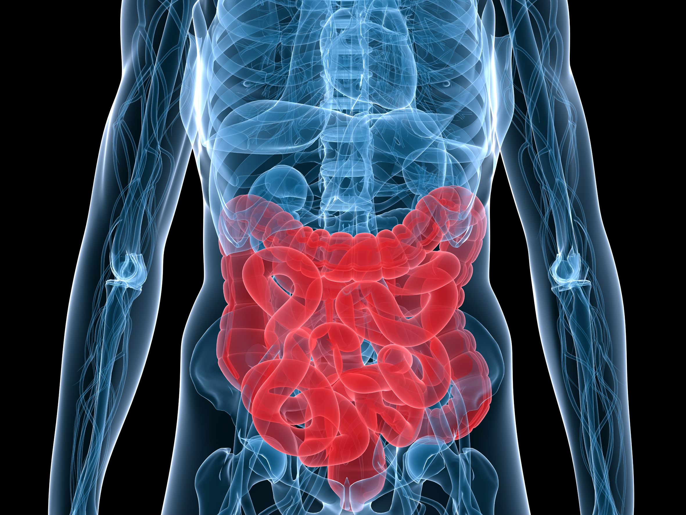 Cancer de colon y ganglios afectados
