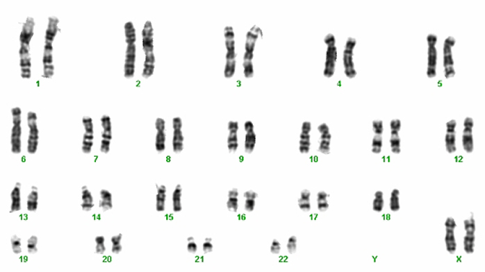 Estudio genético prenatal