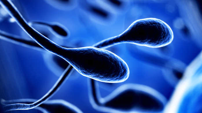 Microdeleciones cromosoma Y